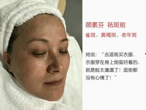 去斑视频,焕发无瑕肌肤——揭秘高效去斑视频教程