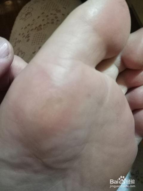 去除鸡眼视频,跟随视频教程学除法