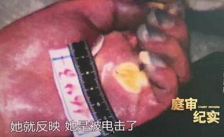 被电死视频,揭秘电击事故现场惊心动魄一幕