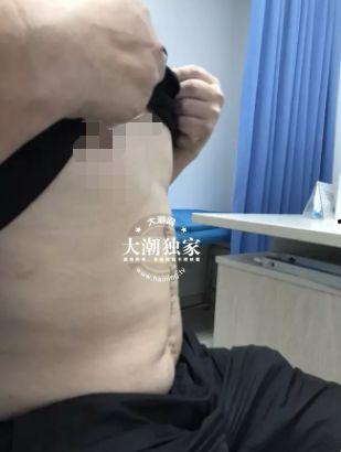 肚子突然变大视频,揭秘神秘现象背后的真相