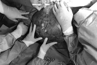 肚子突然变大视频,揭秘神秘现象背后的真相