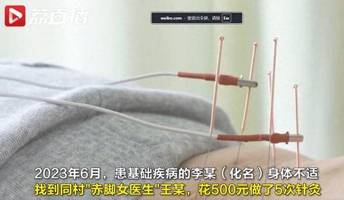女人针灸视频,女性健康养生的秘密武器