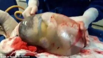 新生儿出生视频,见证生命的奇迹