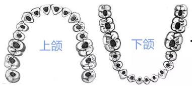 开髓视频,直观展示医学技术的进步